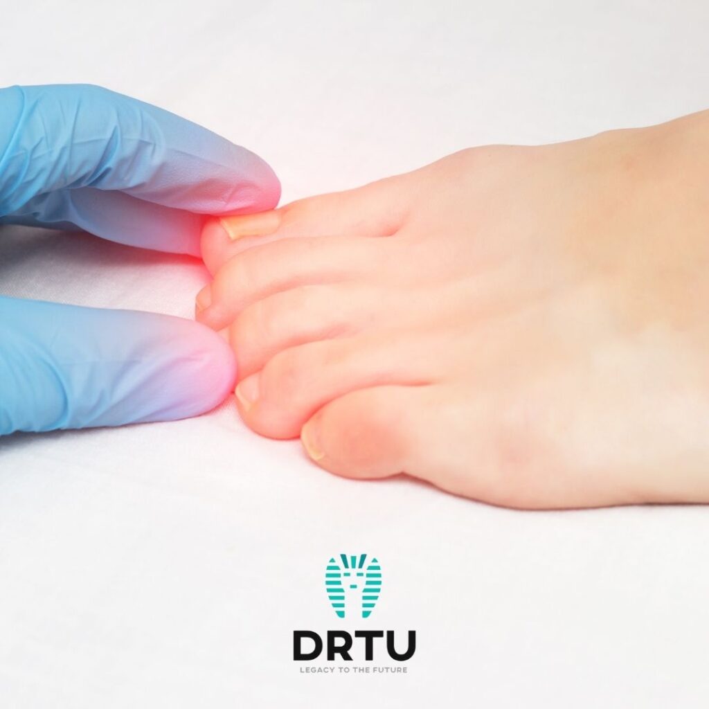 Tırnak Mantarı Neden Olur