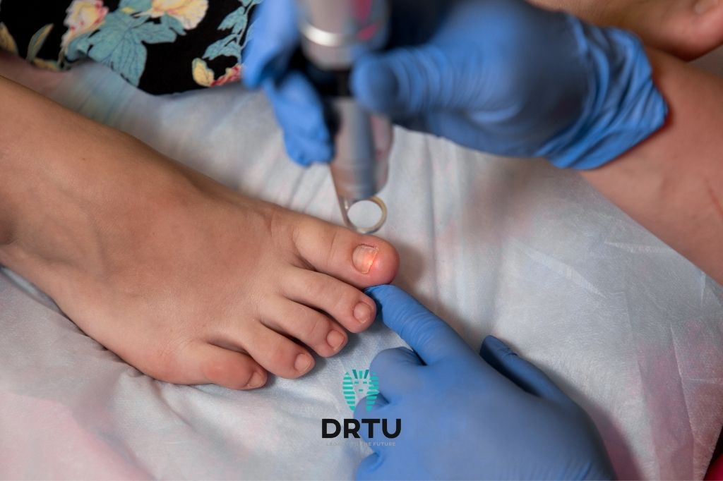 Tırnak Mantarı Tedavisi